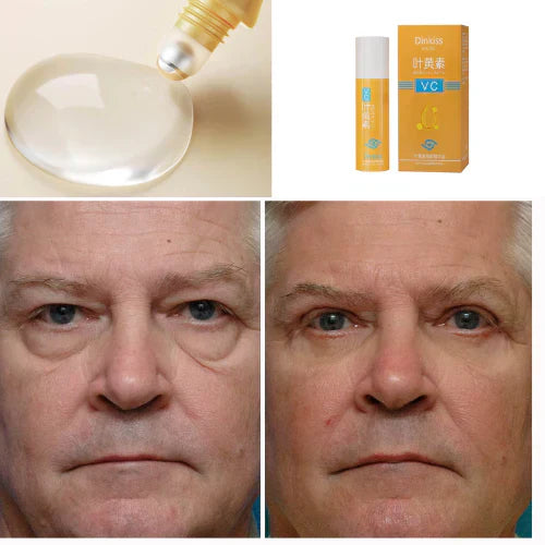 Rolon 5 em 1 Ultra Rejuvenescedor Luteína Inova®